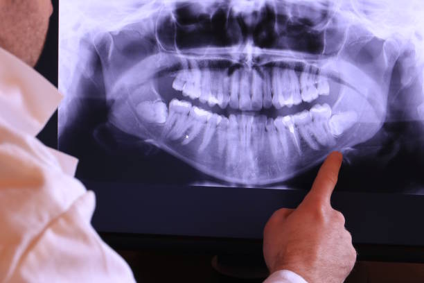 Best Emergency Cosmetic Dentistry (e.g., broken veneers) in Memphis, TX